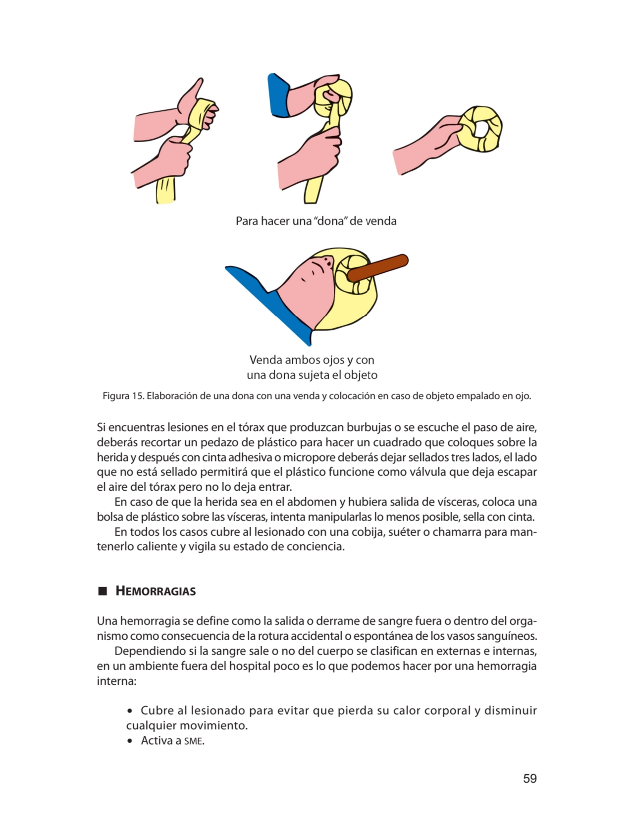 59
Figura 15. Elaboración de una dona con una venda y colocación en caso de objeto empalado en ojo…