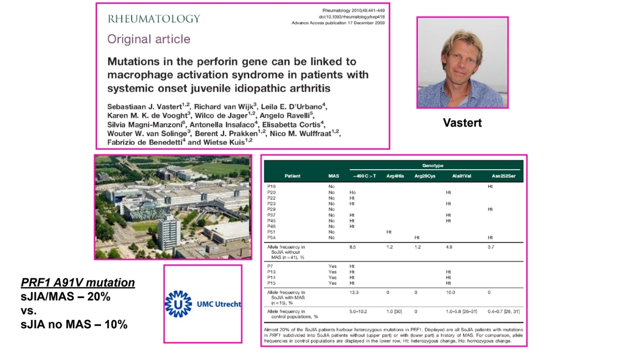 Vastert
PRF1 A91V mutation
sJIA/MAS – 20%
vs.
sJIA no MAS – 10%