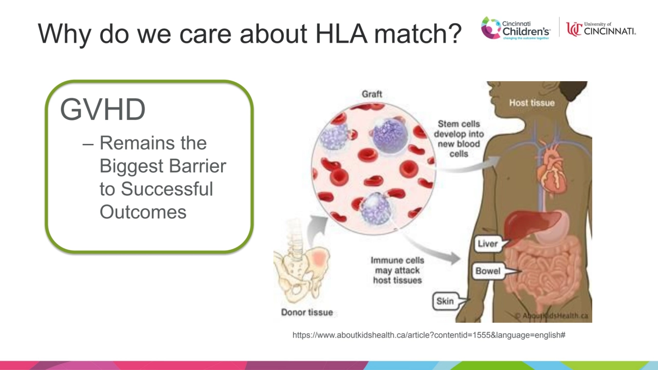 Why do we care about HLA match?
GVHD
– Remains the 
Biggest Barrier 
to Successful 
Outcomes
…