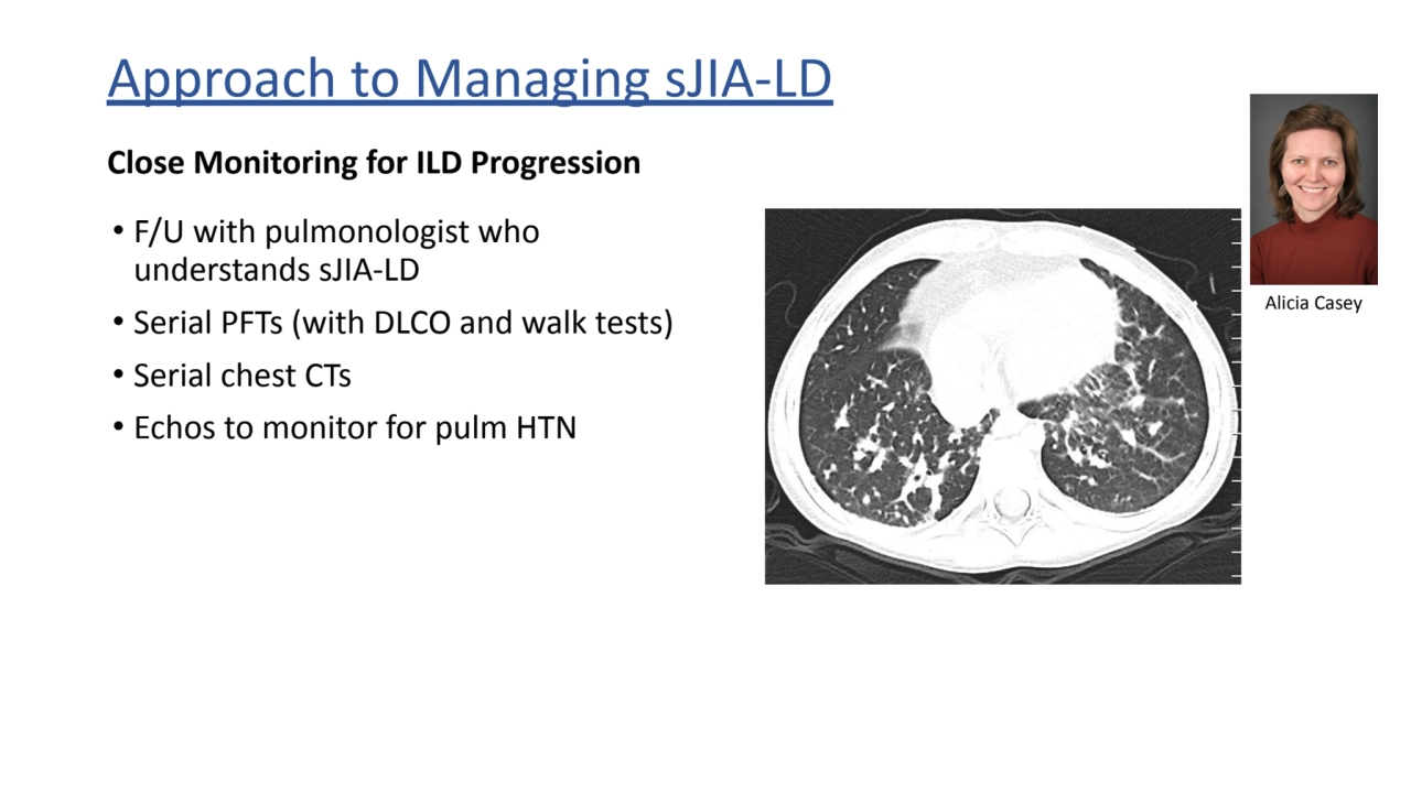 Approach to Managing sJIA-LD
Close Monitoring for ILD Progression
• F/U with pulmonologist who 
…