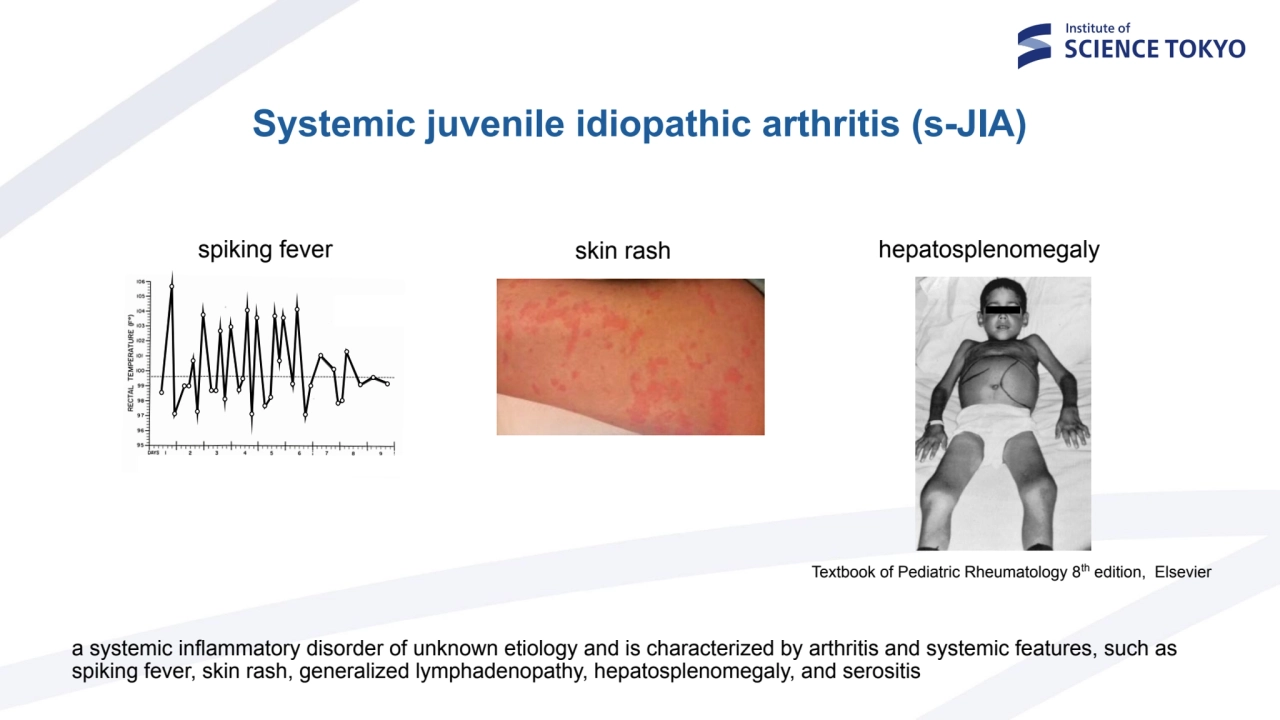 Systemic juvenile idiopathic arthritis (s-JIA)
a systemic inflammatory disorder of unknown etiolog…