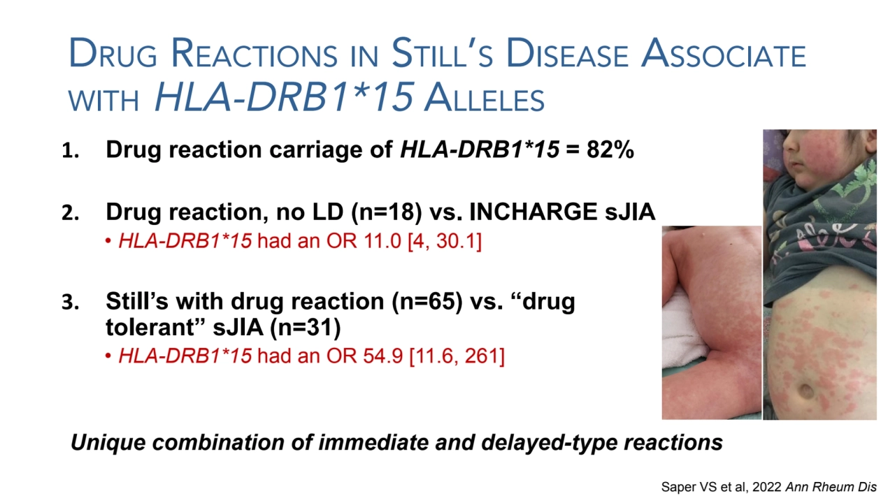 DRUG REACTIONS IN STILL’S DISEASE ASSOCIATE
WITH HLA-DRB1*15 ALLELES
1. Drug reaction carriage of…