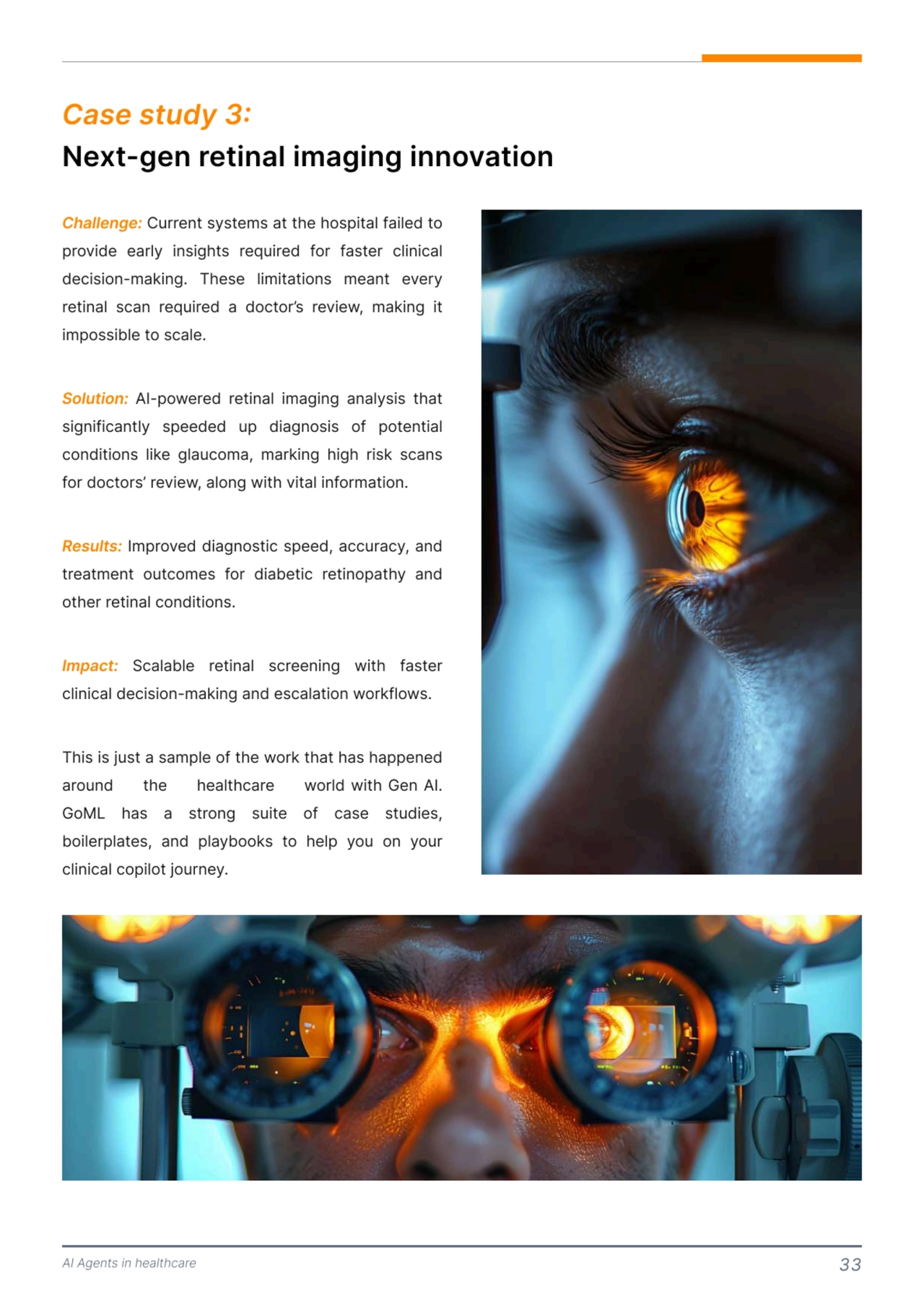 AI Agents in healthcare 33
Next-gen retinal imaging innovation
Case study 3: 
Challenge:
Solution: 
Results:
Impact:
 Current systems at the hospital failed to 
provide early insights required for faster clinical 
decision-making. These limitations meant every 
retinal scan required a doctor’s review, making it 
impossible to scale. 

AI-powered retinal imaging analysis that 
significantly speeded up diagnosis of potential 
conditions like glaucoma, marking high risk scans 
for doctors’ review, along with vital information. 

 Improved diagnostic speed, accuracy, and 
treatment outcomes for diabetic retinopathy and 
other retinal conditions. 

 Scalable retinal screening with faster 
clinical decision-making and escalation workflows. 

This is just a sample of the work that has happened 
around the healthcare world with Gen AI. 
GoML has a strong suite of case studies, 
boilerplates, and playbooks to help you on your 
clinical copilot journey. 