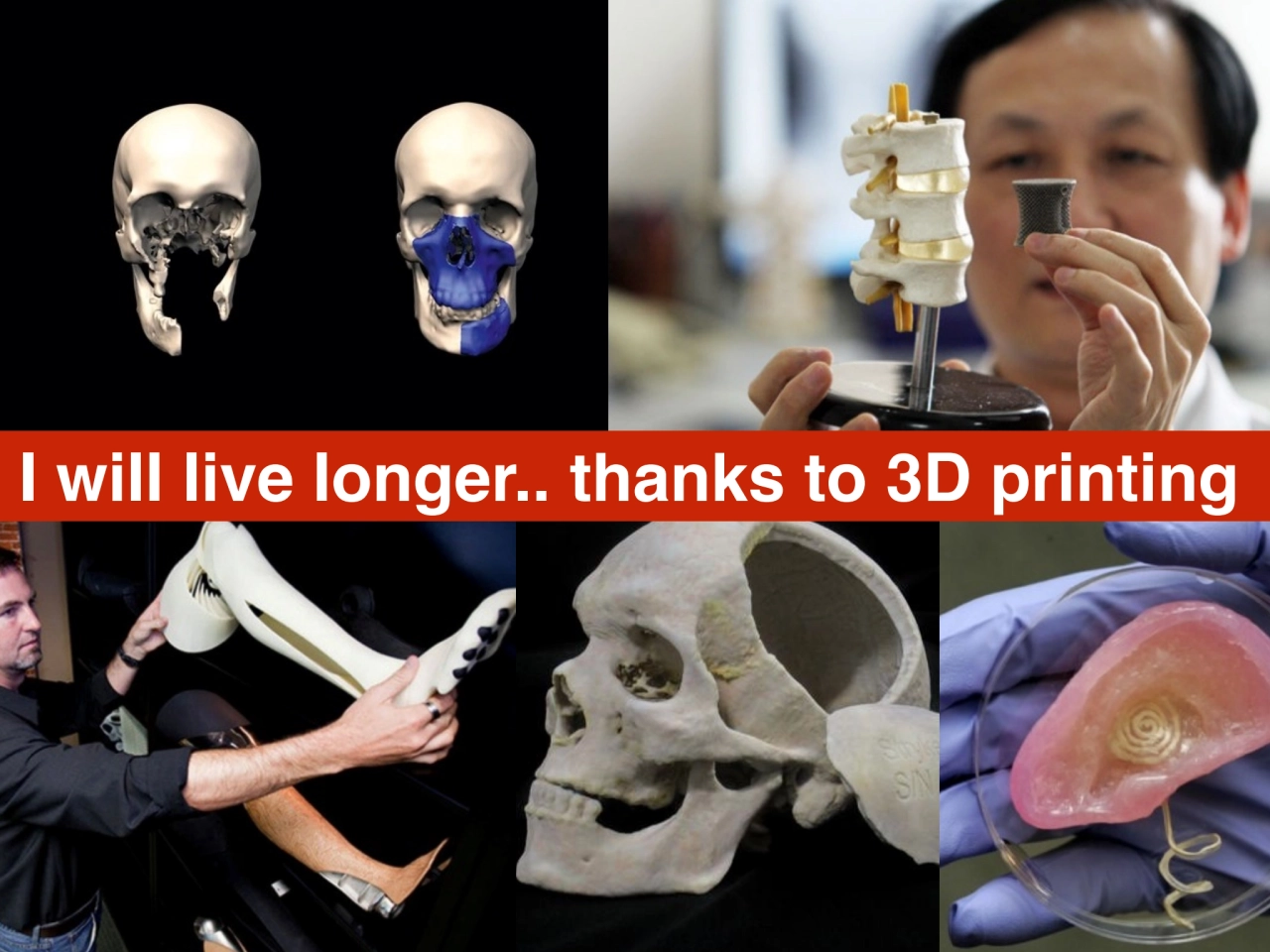 I will live longer.. thanks to 3D printing