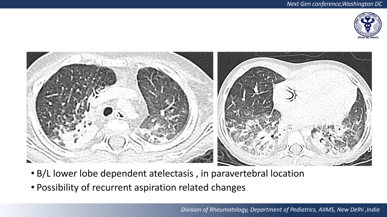 Next Gen conference,Washington DC 
Division of Rheumatology, Department of Pediatrics, AIIMS, New …