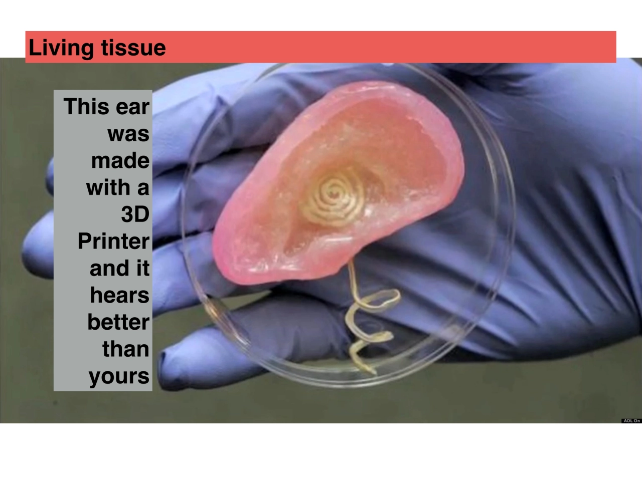 This ear 
was 
made 
with a
3D 
Printer
and it
hears 
better
than 
yours
Living tissue