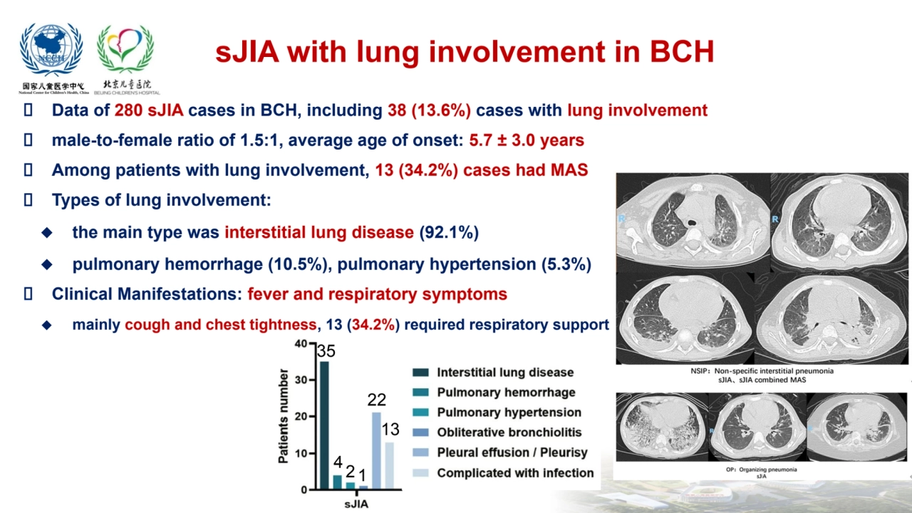  Data of 280 sJIA cases in BCH, including 38 (13.6%) cases with lung involvement
 male-to-female r…