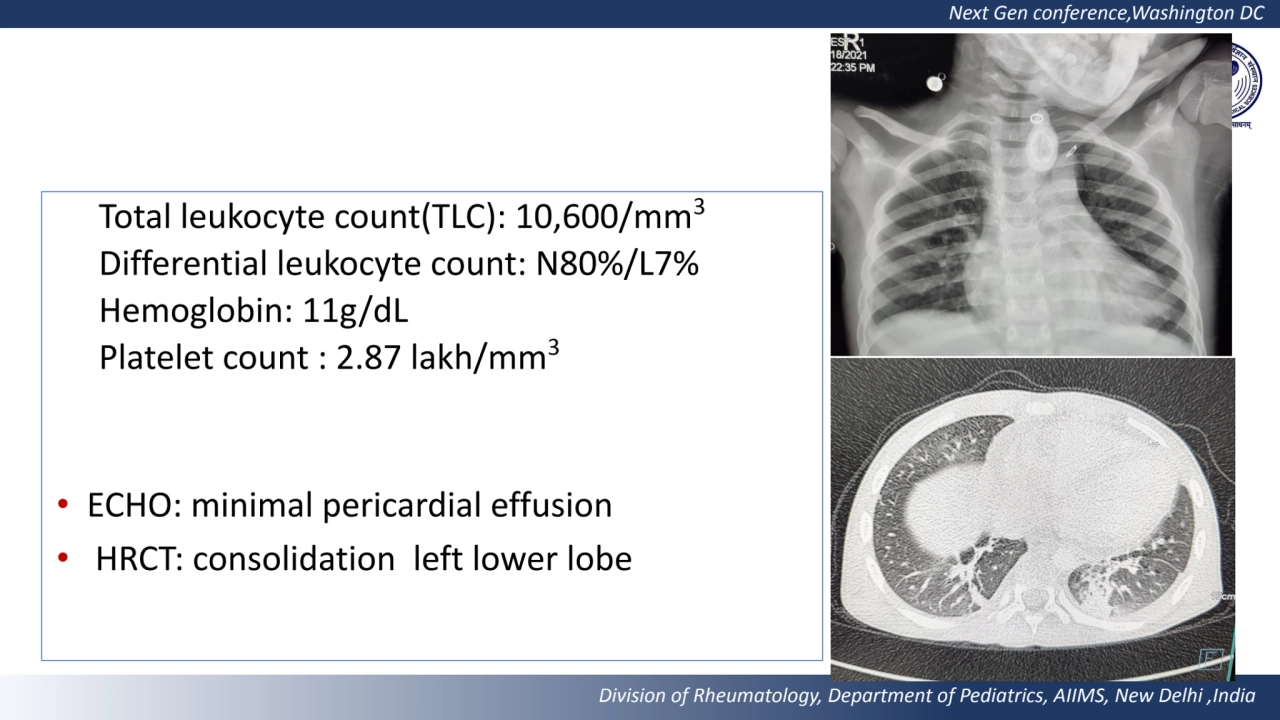 Next Gen conference,Washington DC 
Division of Rheumatology, Department of Pediatrics, AIIMS, New …
